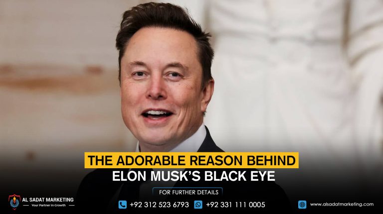 The Adorable Reason Behind Elon Musk’s Black Eye