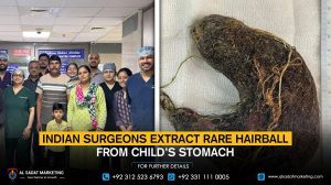 Indian surgeons extract rare hairball from child’s stomach