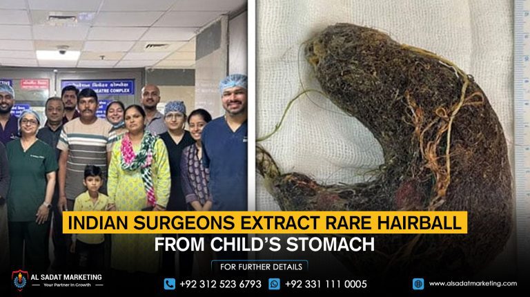 Indian surgeons extract rare hairball from child’s stomach
