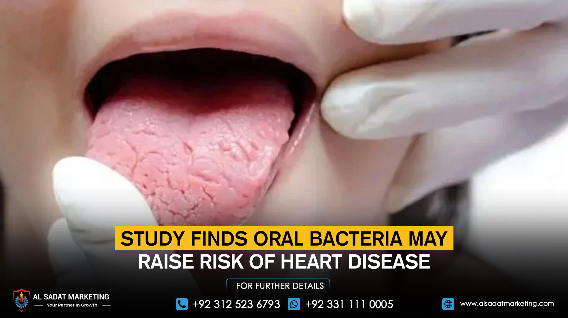 Study finds oral bacteria may raise risk of heart disease
