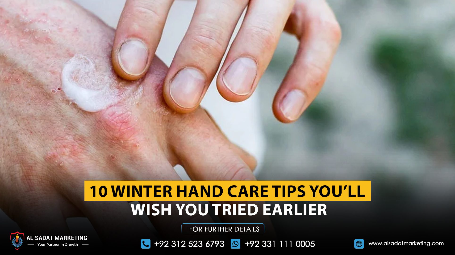 10 Winter Hand Care Tips You’ll Wish You Tried Earlier